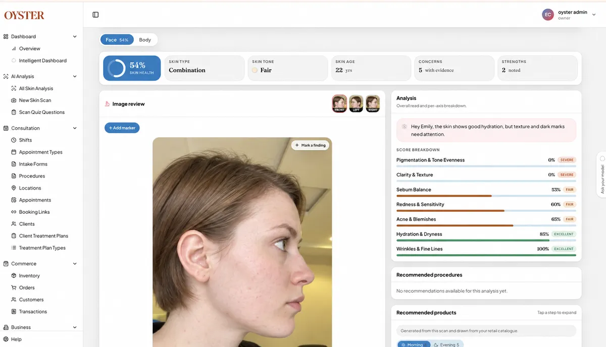 Oyster skin analysis with facial scan and concern scores